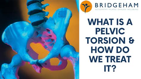 pelvic torsion test|pelvic torsion surgery.